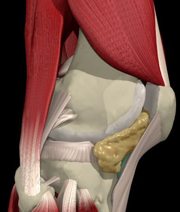 LATERAL MENISCUS LCL BICEPS